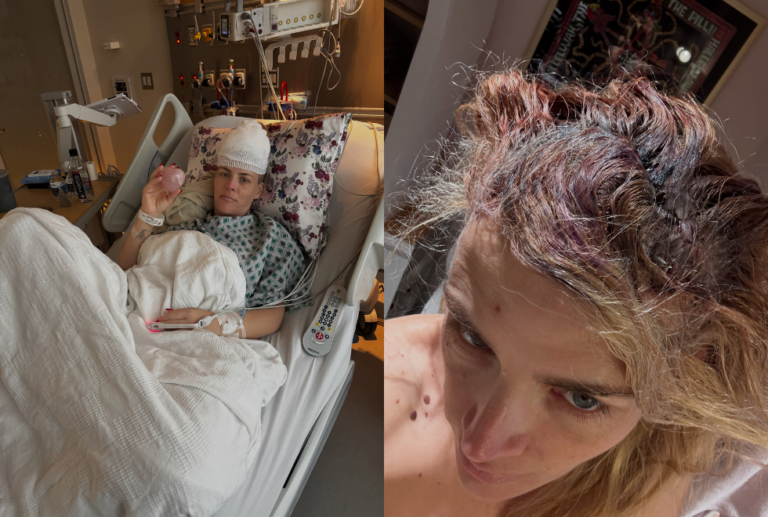 Busy Philipps, atriz de “As Branquelas”, retira tumor cerebral e passa por cirurgia
